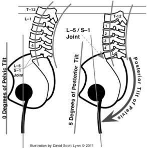 don't get stuck with a pelvic tuck